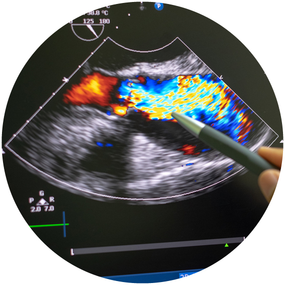photo of an ultrasound