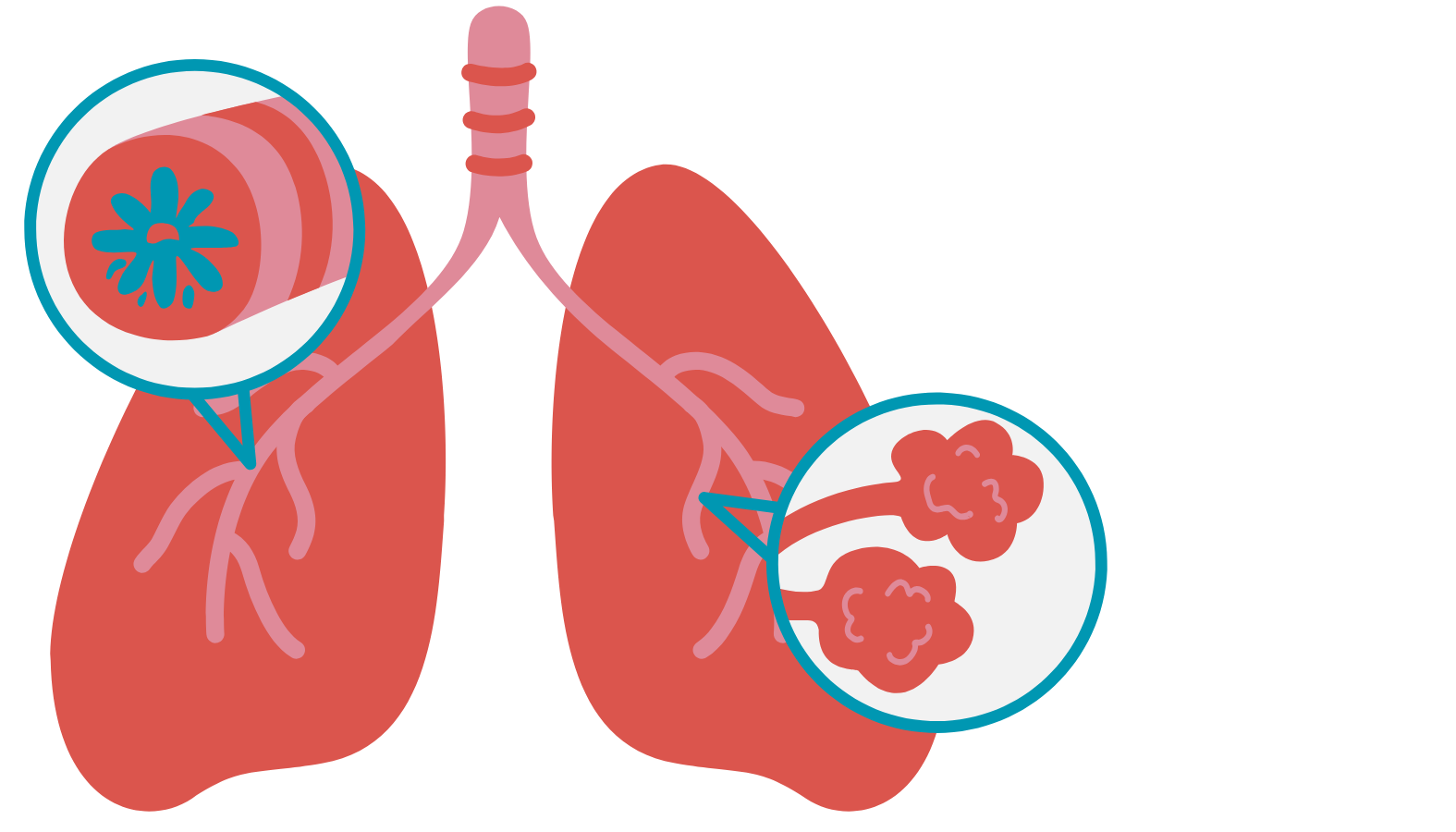 lungs