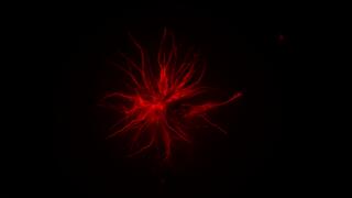 Fluorescent microscopy image of a retinal pigment epithelial (RPE) cell with actin filaments stained in bright red, radiating outward in branching, star-like patterns against a black background.